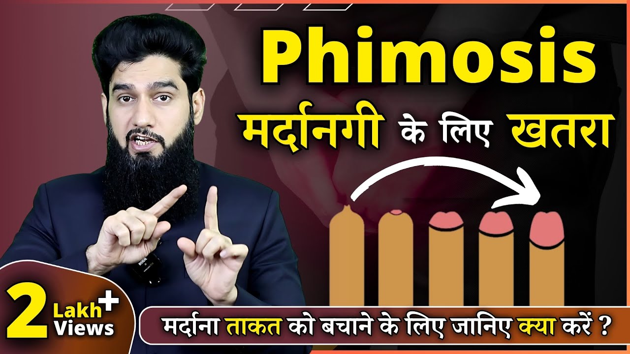 Phimosis - Causes & Treatment | Paraphimosis Treatment Without Surgery | Dr. Imran Khan in HINDI