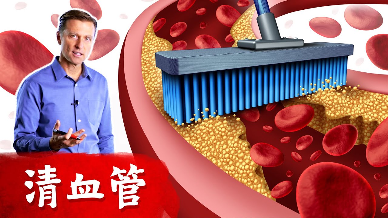 清血管的最好食物, 血管硬化,高血壓的食療,柏格醫生dr berg