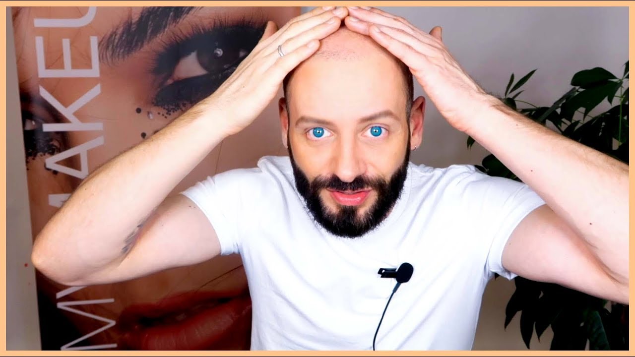 WAAROM BEN IK KAAL? WONDERMIDDELEN TEGEN KAALHEID!