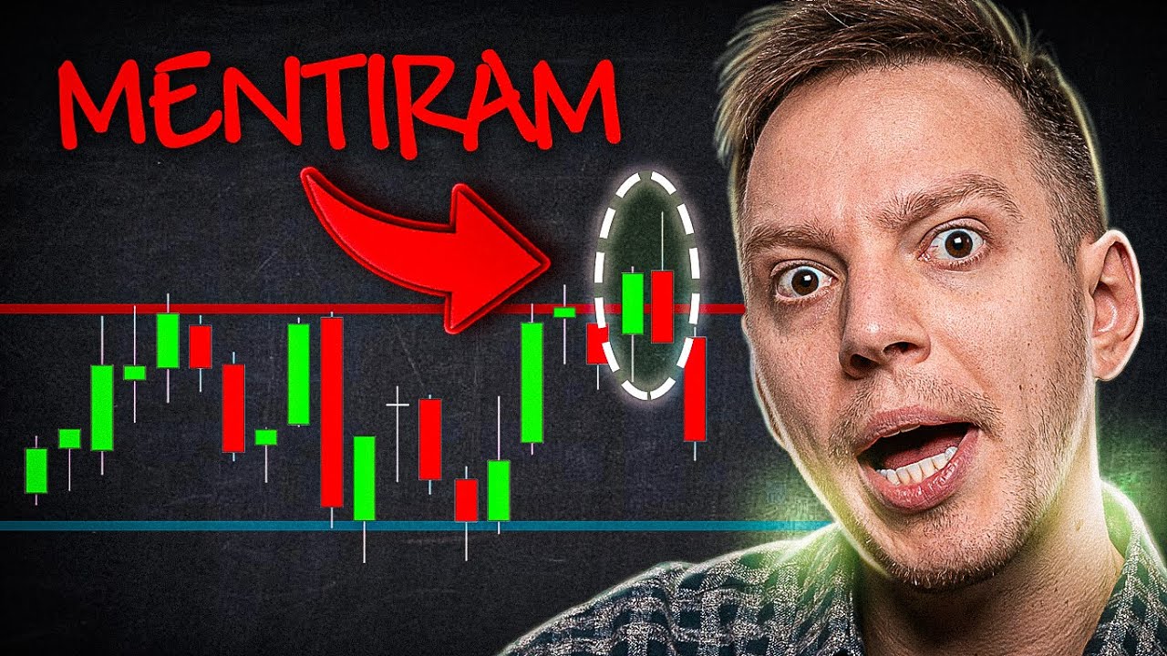 NUNCA MAIS PERCA DINHEIRO💸[Suportes e Resist&ecirc;ncias]