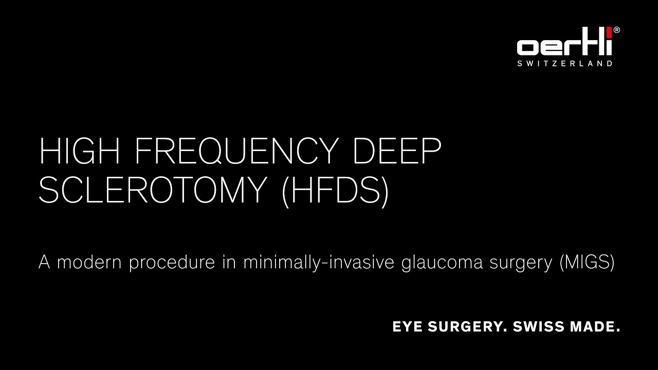 Spotlight: HFDS High Frequency Deep Sclerotomy