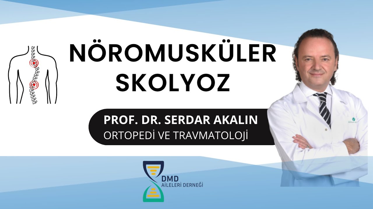 Nöromusküler Skolyoz - Prof. Dr. Serdar Akalın