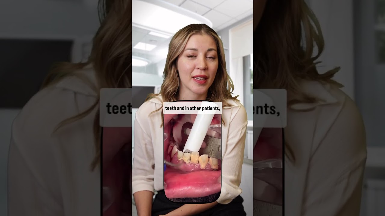 OMG! What&rsquo;s is that? #periodontist #dentaltreatment #periodontology