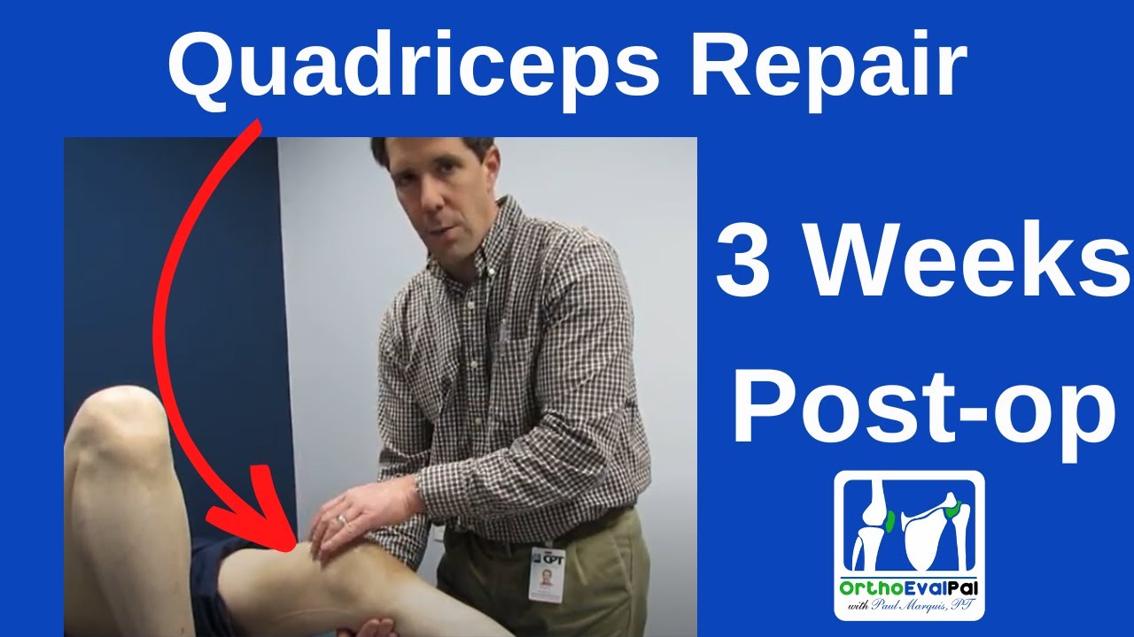Quadriceps Repair 3 Weeks Post Op