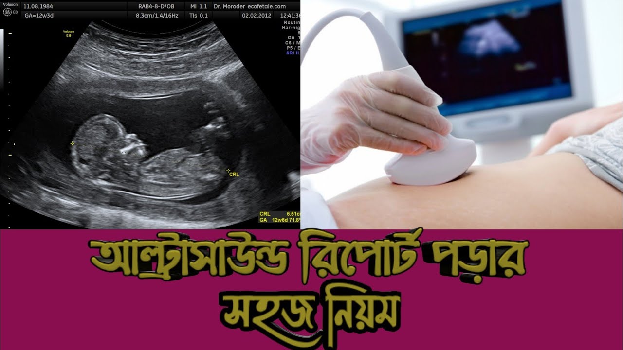 আল্ট্রাসাউন্ড রিপোর্ট পড়ার সহজ নিয়ম | গর্ভের সন্তান ছেলে নাকি মেয়ে