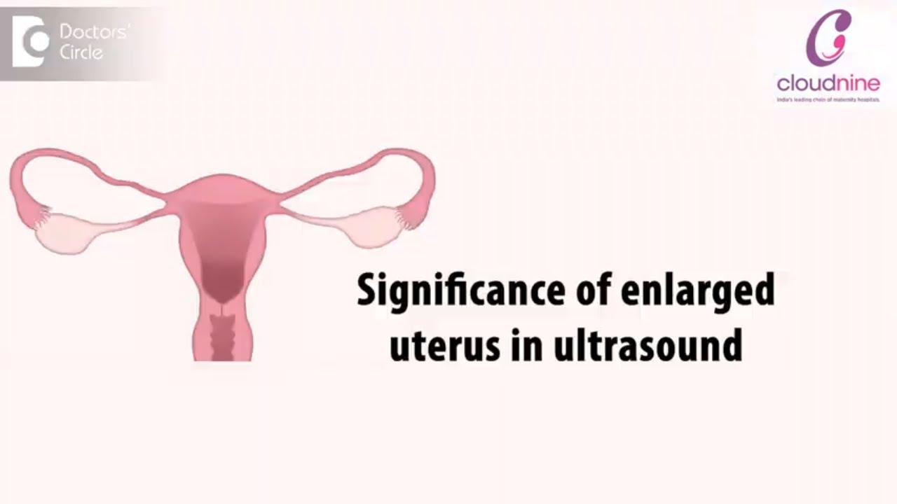 Significance of enlarged or abnormally shaped uterus in ultrasound -Dr.Meeta Nakhare of C9 Hospitals
