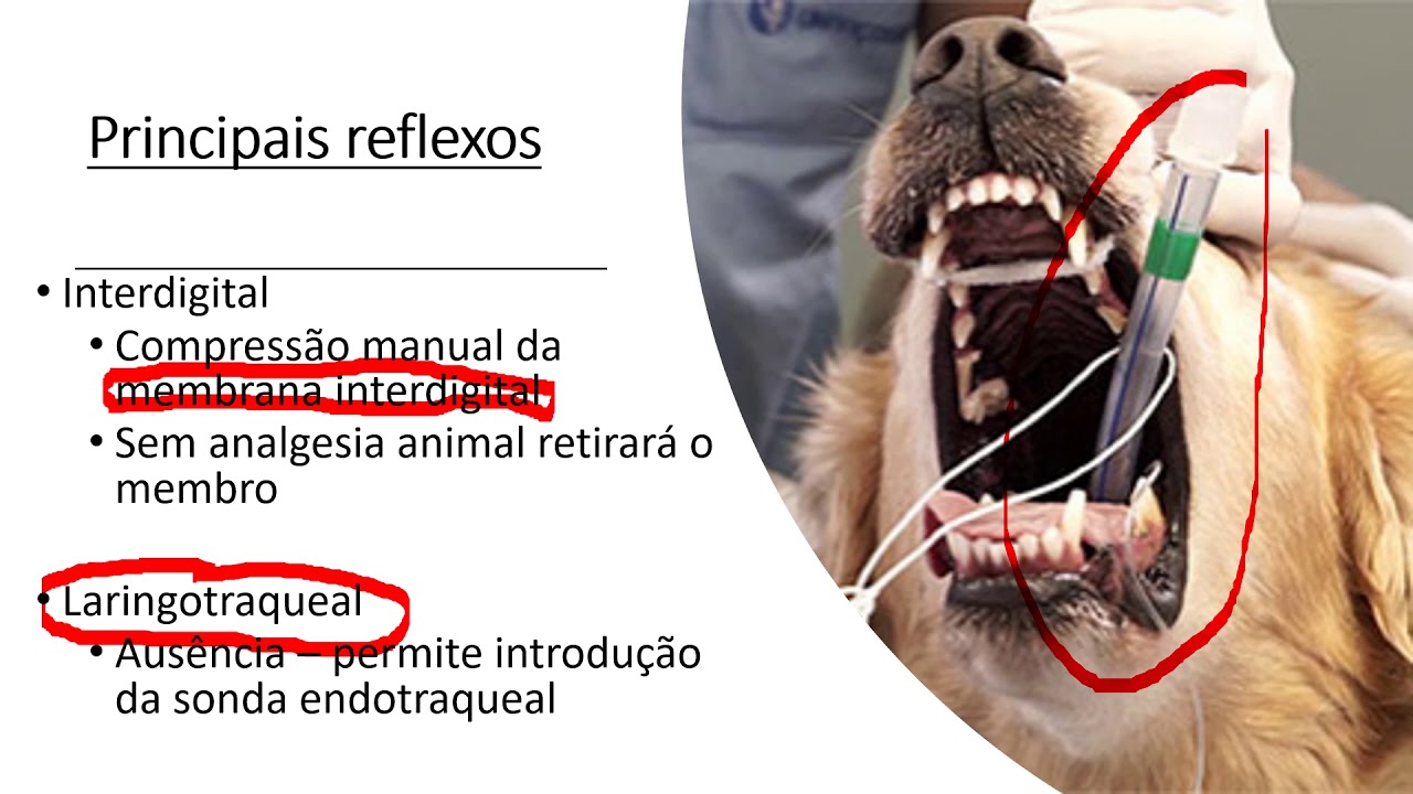 Planos anestésicos   video