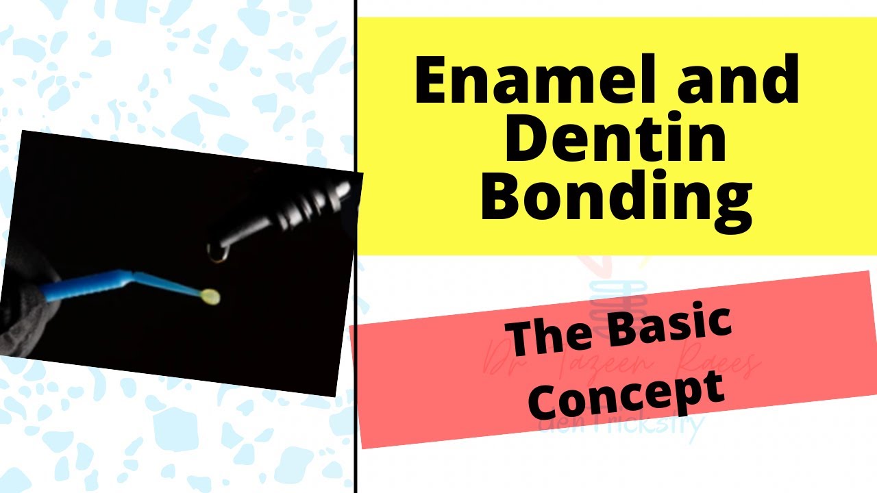 Enamel & Dentin Bonding Simplified - Part 1