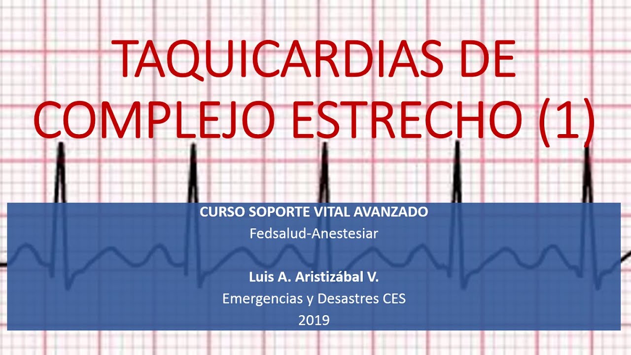 TAQUICARDIA DE COMPLEJO ESTRECHO LUIS ARISTIZABAL ANESTESIAR