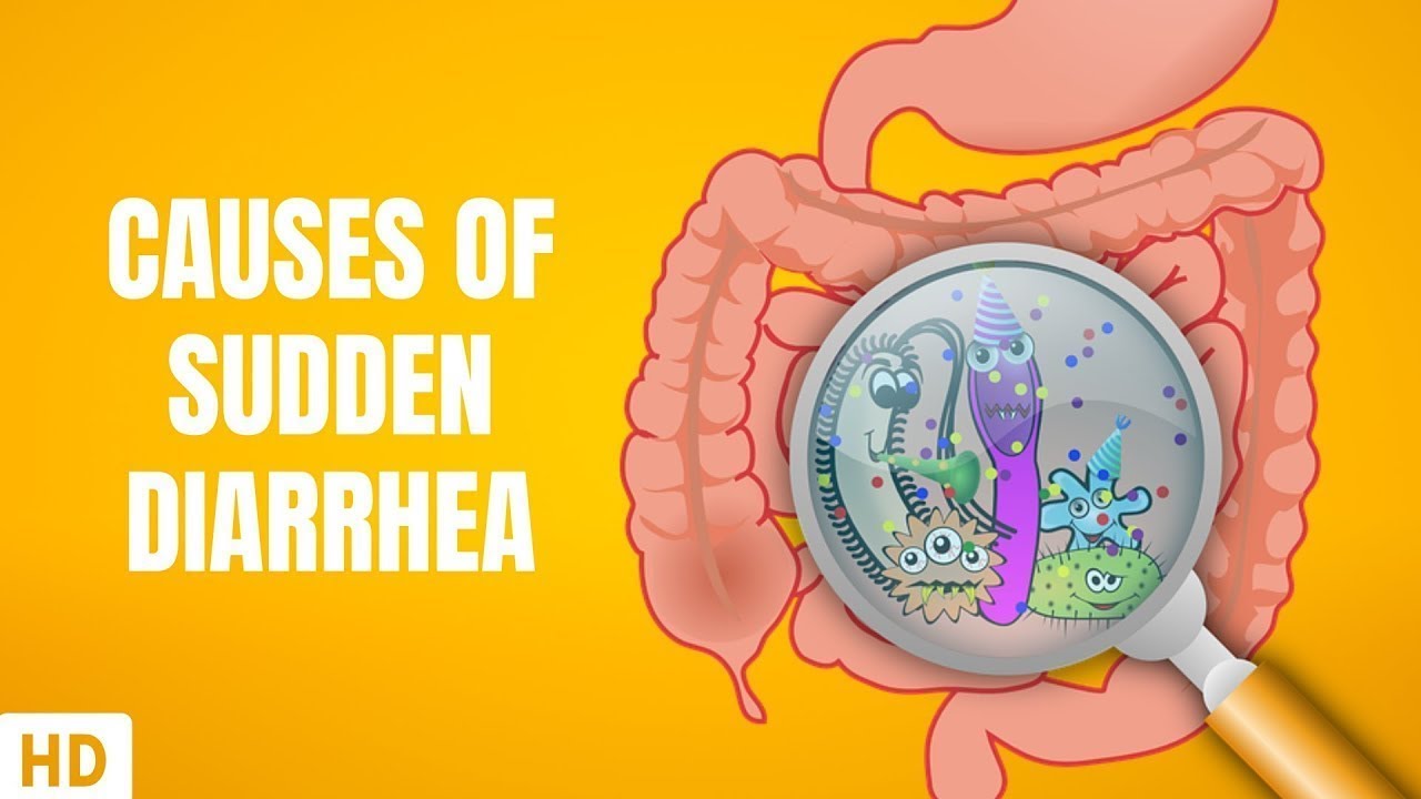 Causes of Sudden Diarrhea