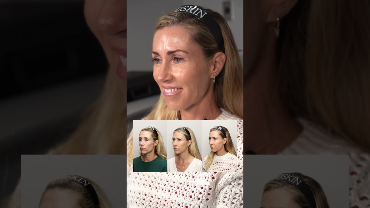 Renuva: Client Check-In #healthyaging #regenerativemedicine #renuva #medicalaesthetics #injectables