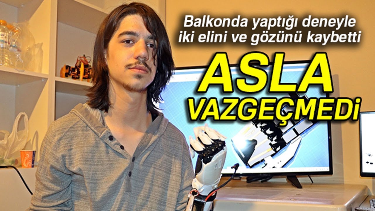Ümidini Kaybetmedi, Kendine Yapay El Yaptı