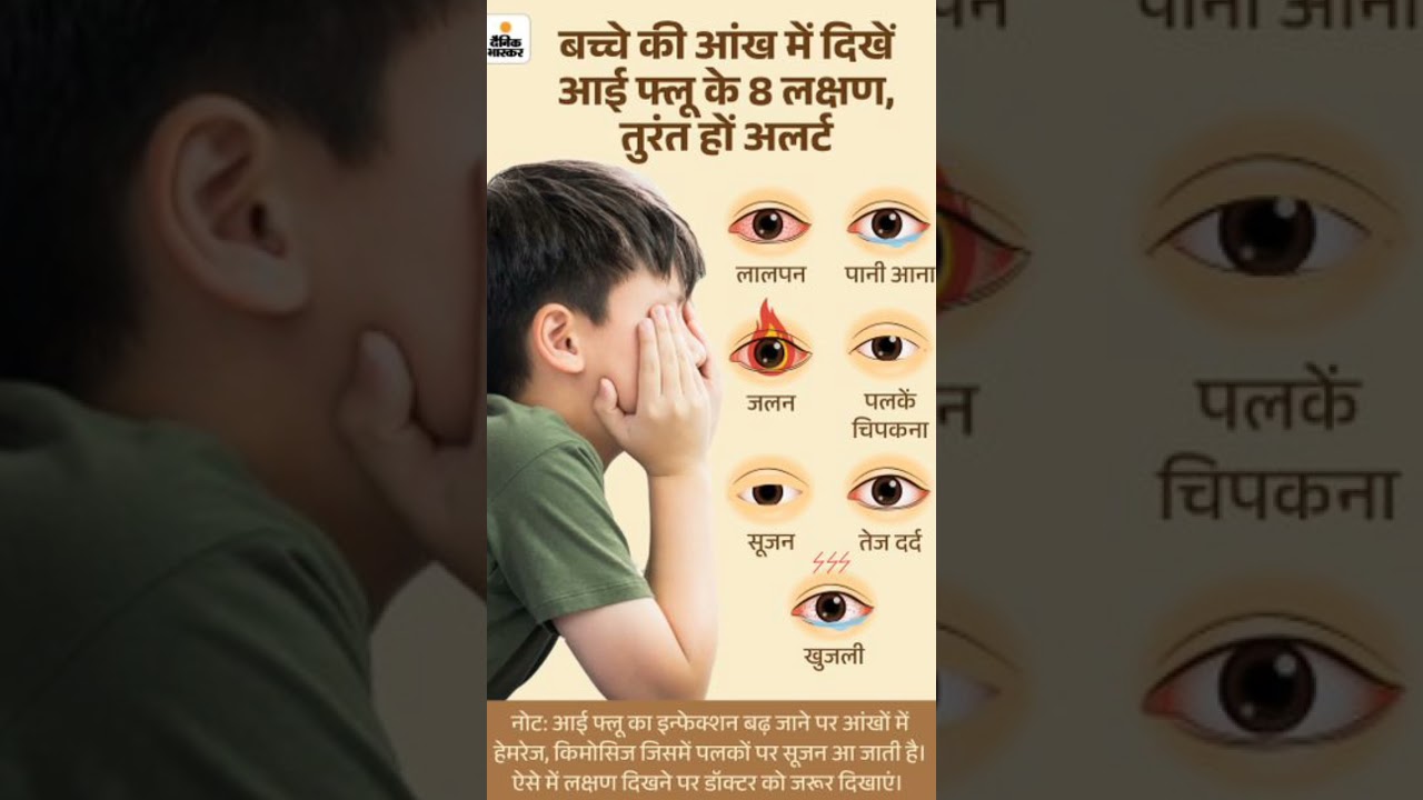 Eye Flu 