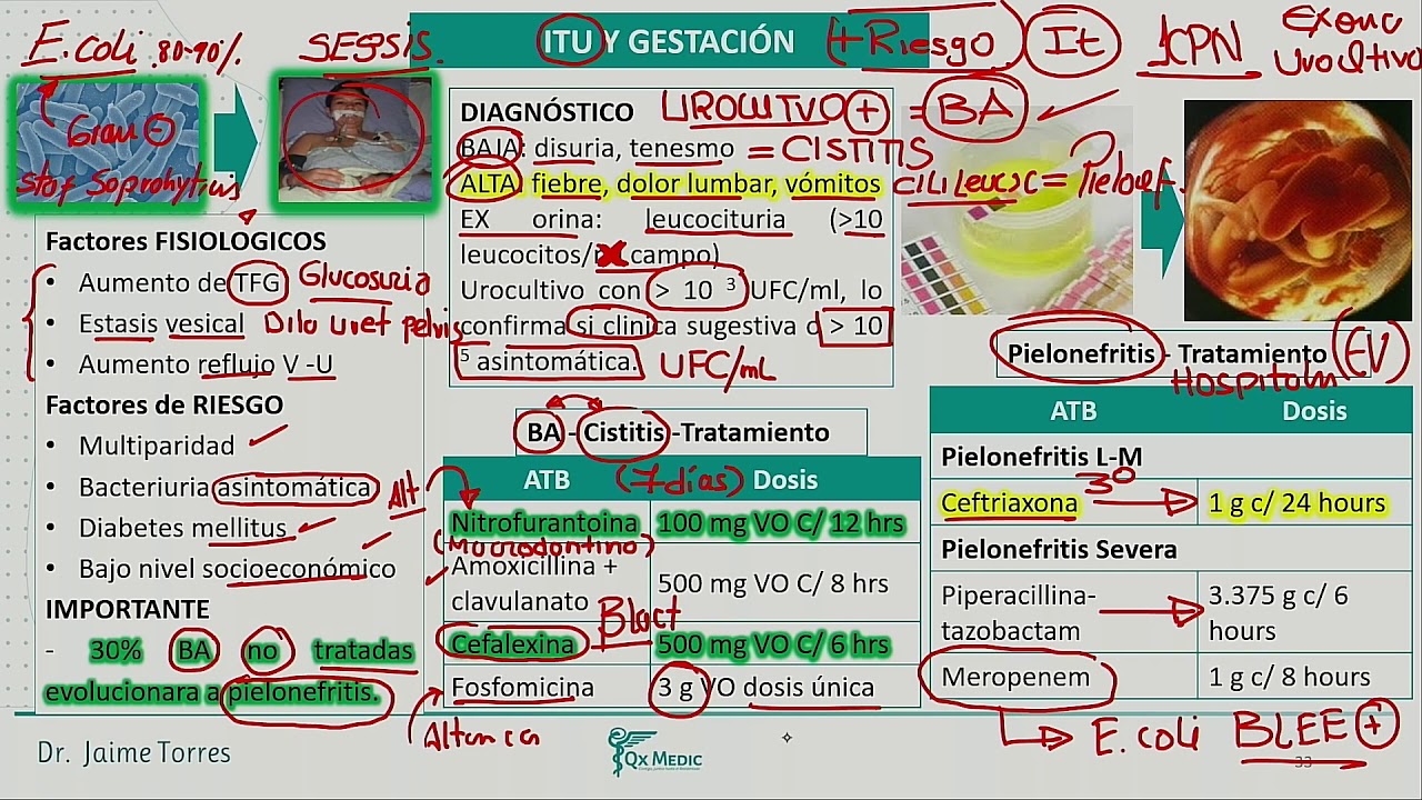 Infecciones ITU - Puerperio OBSTETRICIA