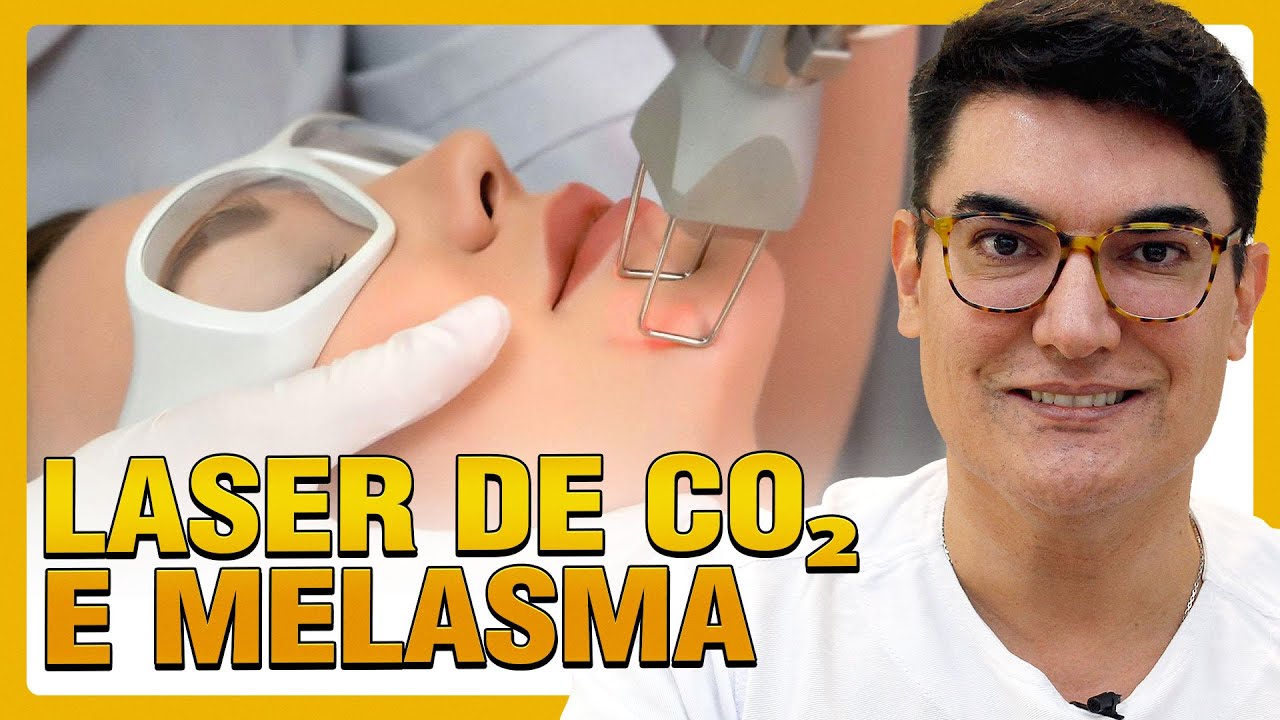 LASER DE CO₂ E MELASMA