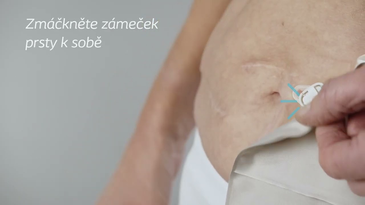 SenSura Mio Convex - 2dílný uzavřený sáček s konvexní podložkou (nové vylepšené upínání) - návod