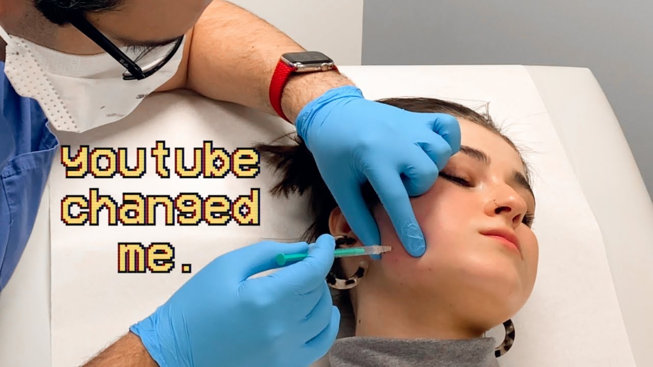 i got botox at 21 and it changed my life. *TMJ probz*