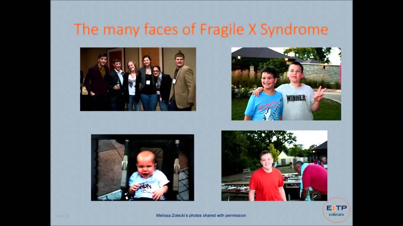 X Chromosome Disorders   Prevention & Developmental Implications in the Early Years