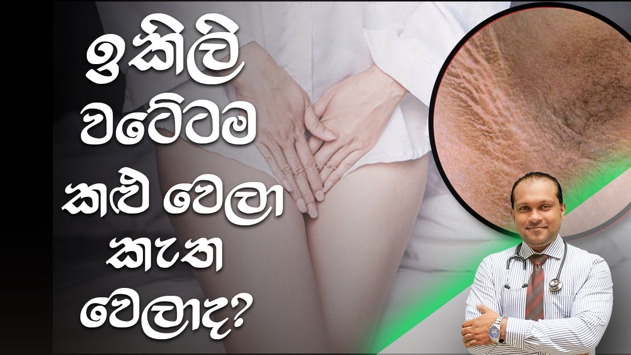 ඉකිලි වටේටම කළු වෙලා කැත වෙලාද? - @behethbydrnamal