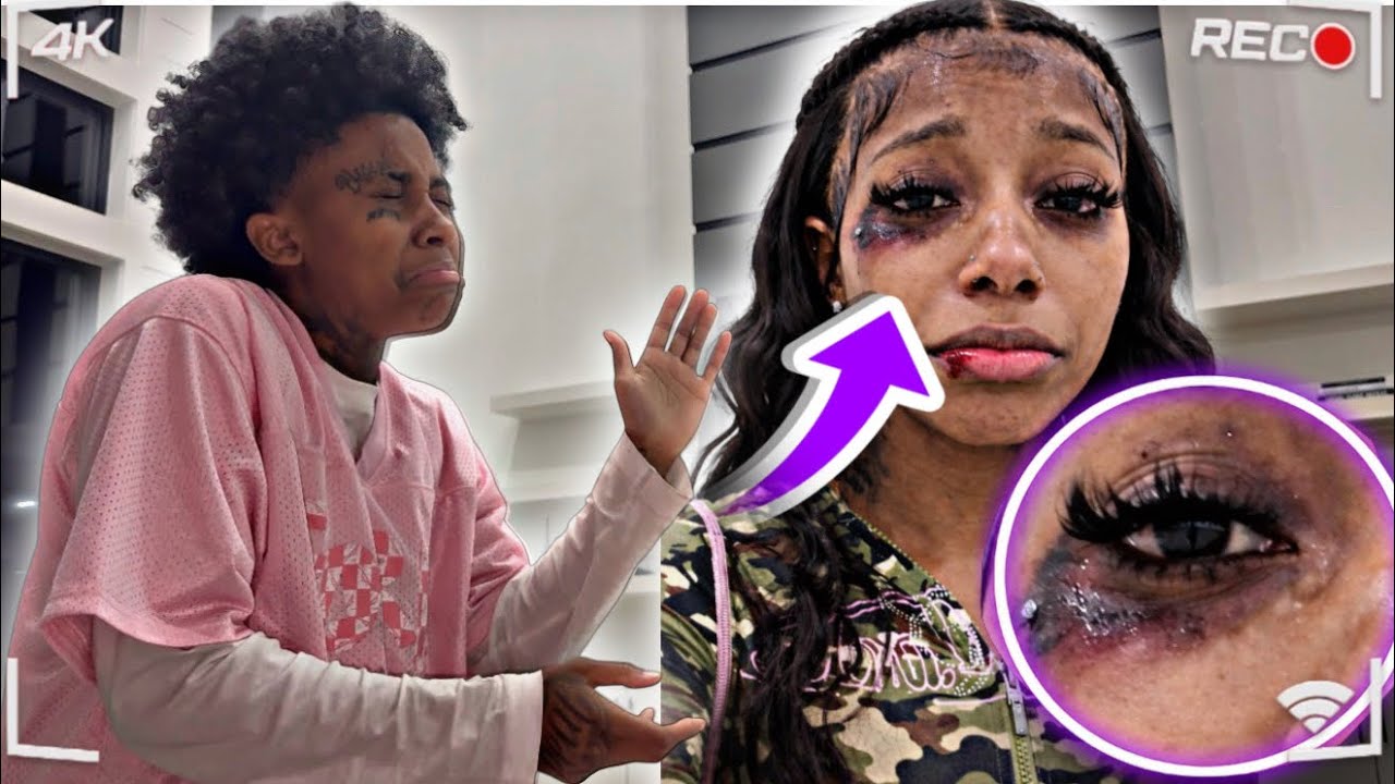 I GOT BEAT UP BAD & SHOWED MY FIANCEE 😱 * NO JOKE *