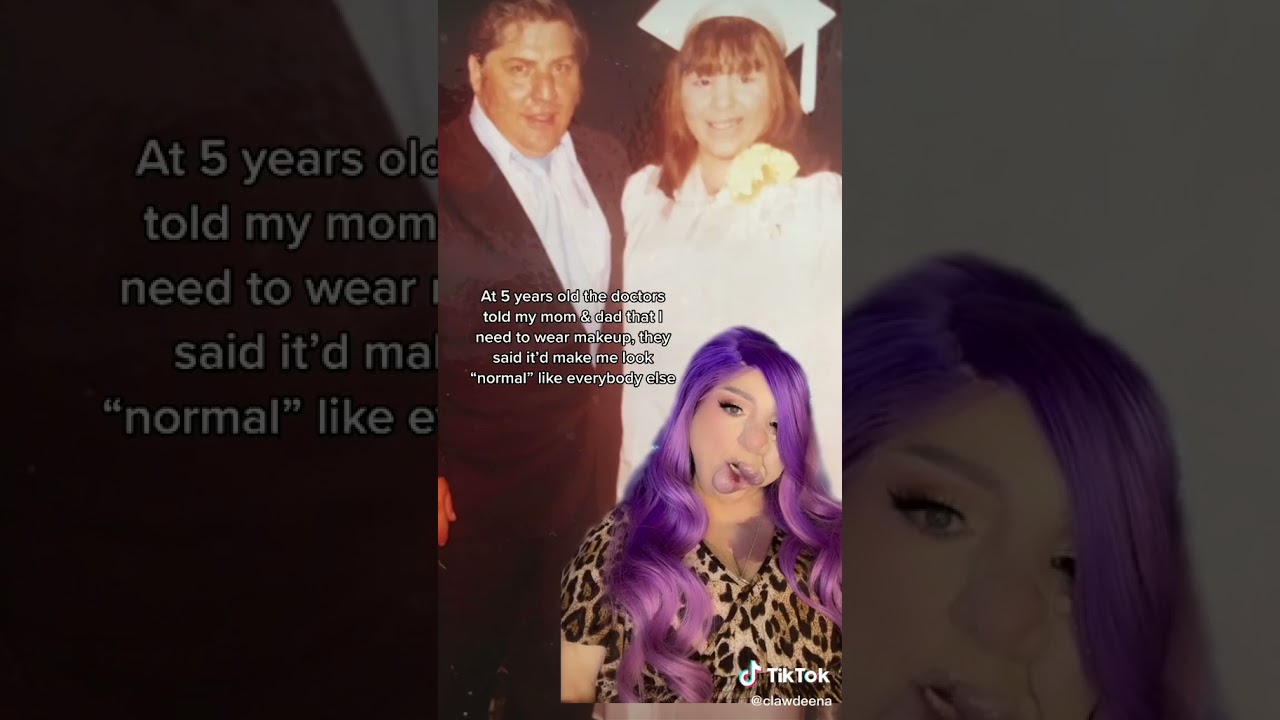 My Rare Birthmark Tiktok clawdeena #shorts #tiktok