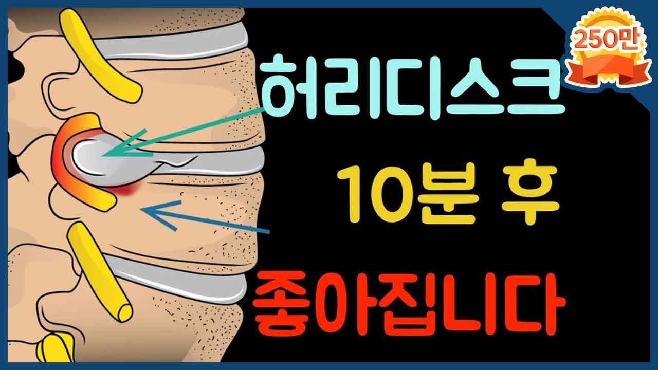[닥터홍선생]#20.허리디스크, 10분만에 평생 좋아지도록 해드립니다.