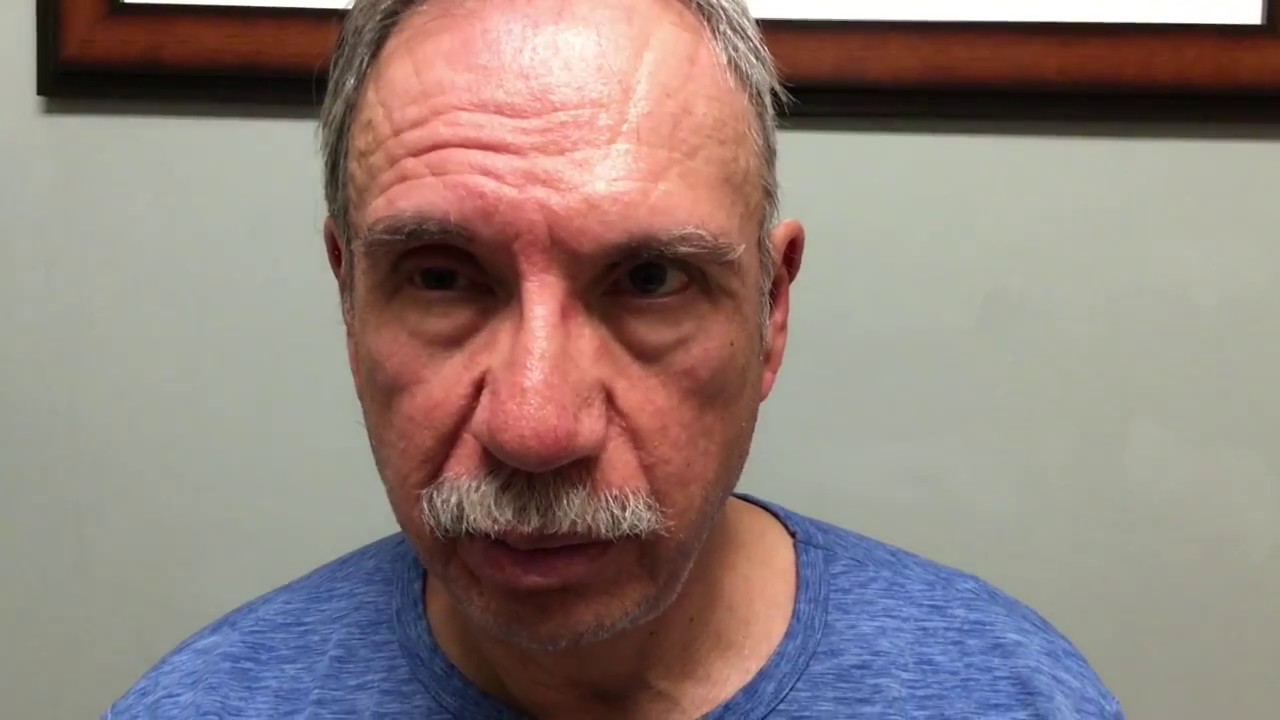 Опущение лица. Инсульт против паралича Белла. Как отличить?