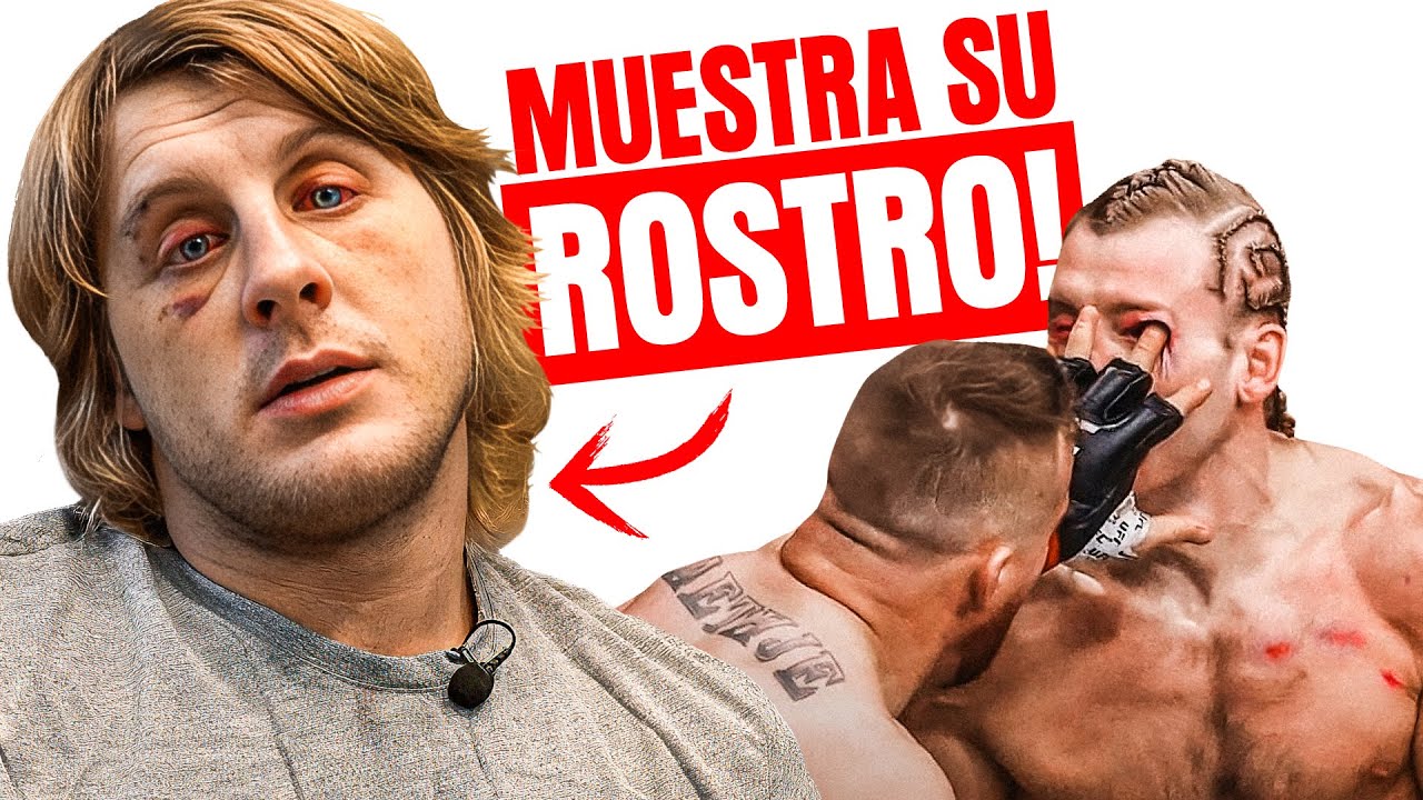 Paddy Pimblett MUESTRA su ROSTRO