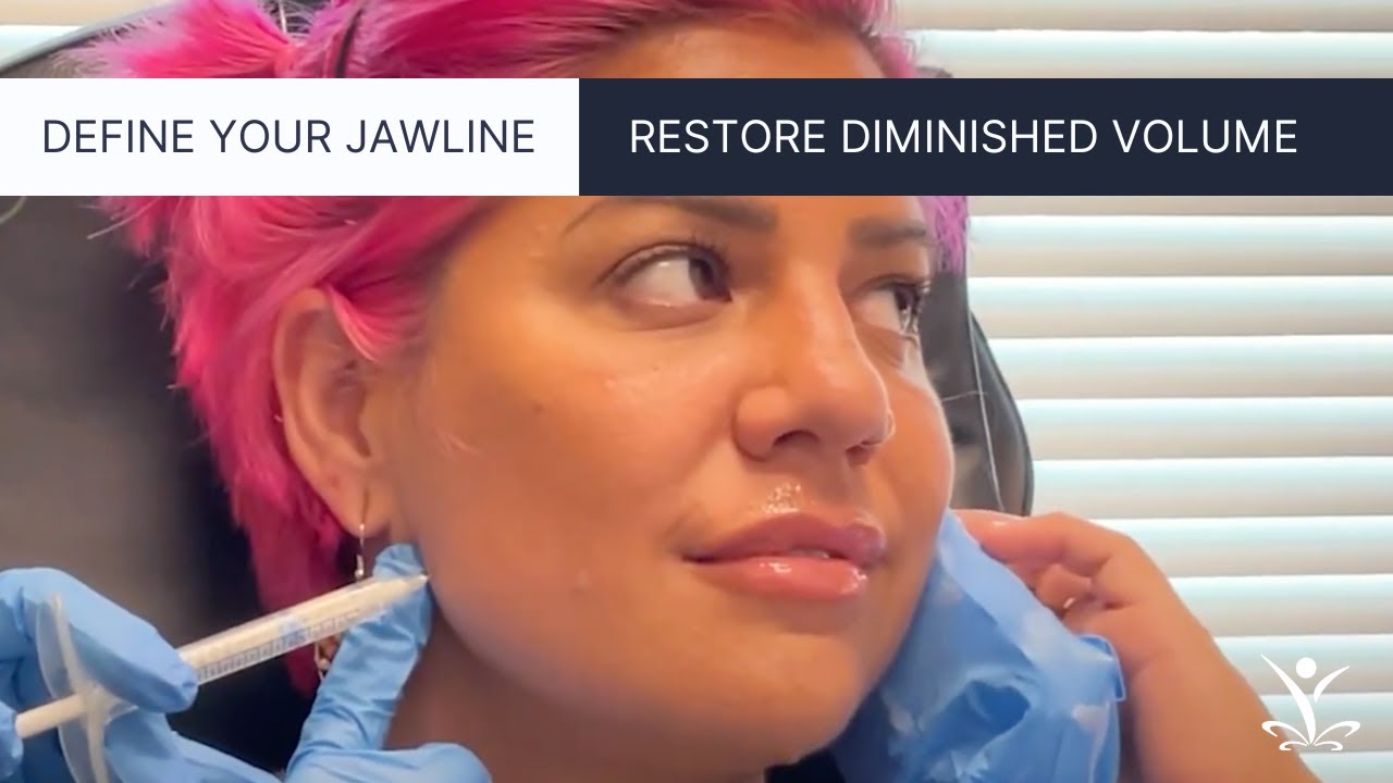 Define Your Jawline with Dermal Filler