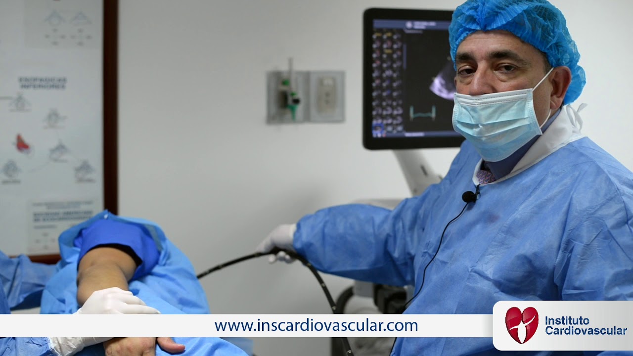 Ecocardiograma Transesofagico