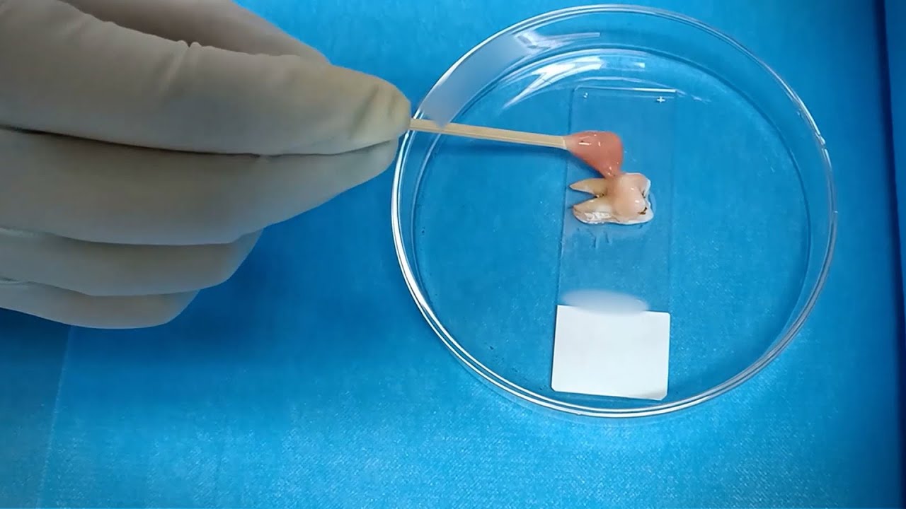 A Green Light Treatment for Whiter Teeth, Fewer Cavities | Headline Science