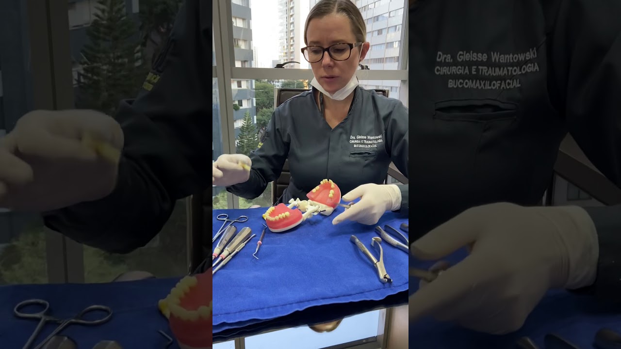 Técnica de exodontia fechada com o uso de alavancas