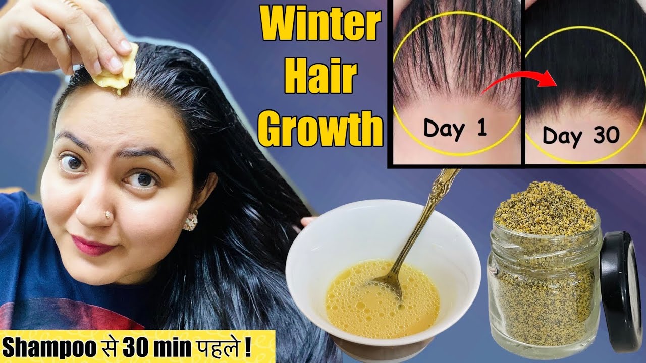 30 Days *Winter Hair Growth* Challenge : Regrow Lost hair, Fix Bald Patches & Hairline in 30 Days💕