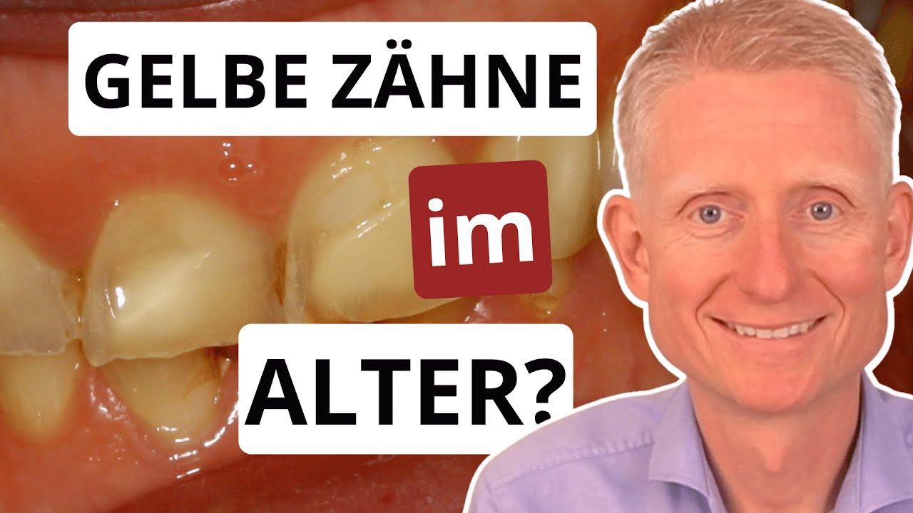 So bekommen Sie schönere Zähne als Ihre Kinder! - mit weißer Keramik