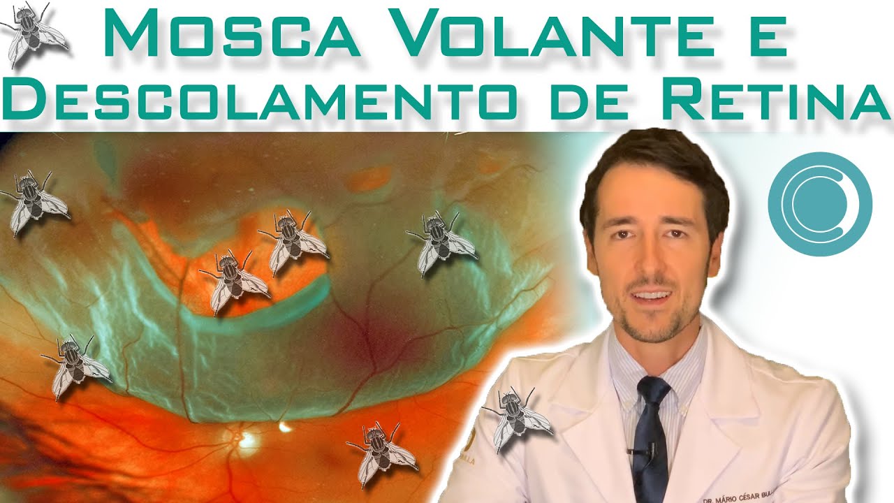 Mosca volante e descolamento de retina s&atilde;o a mesma coisa?