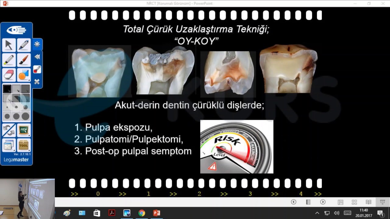 Online DUS Dersleri - Pedodonti - Çocuk Diş Hekimliği / nettekurs.com - Online DUS Kursu