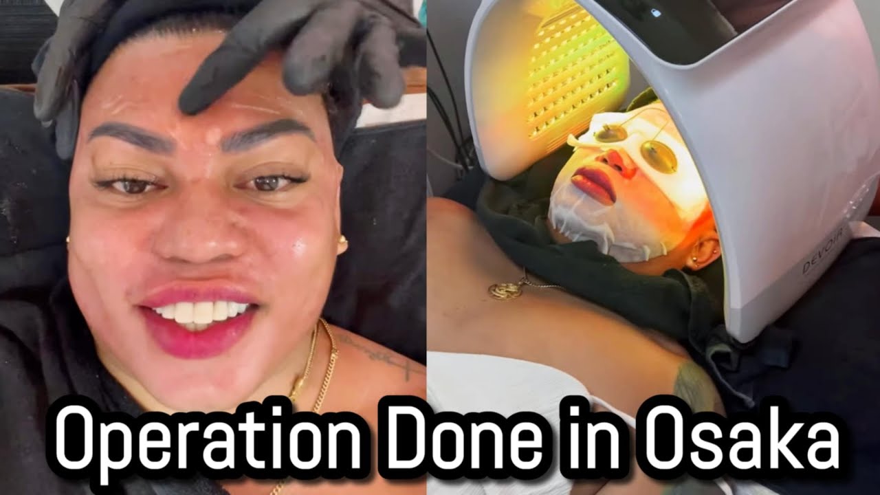 Operation done  in Osaka Japan.