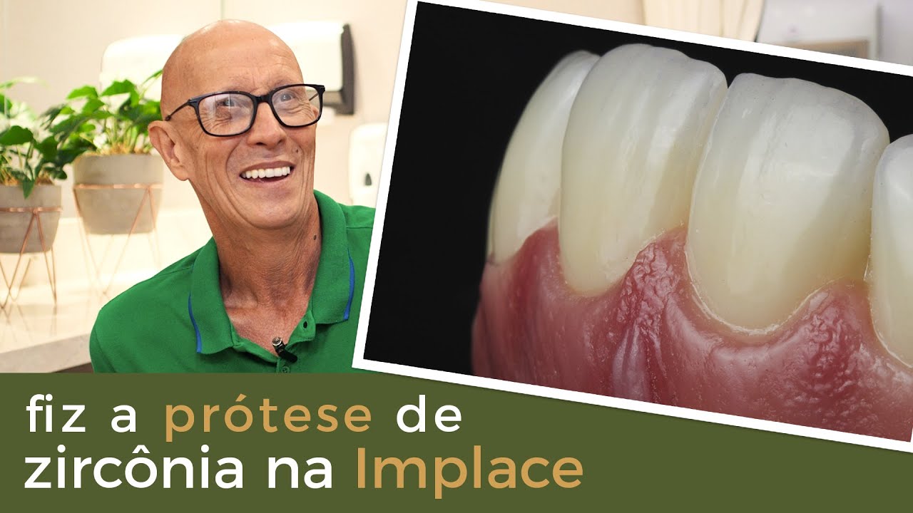 Fiz Minha Prótese de Zircônia na Implace
