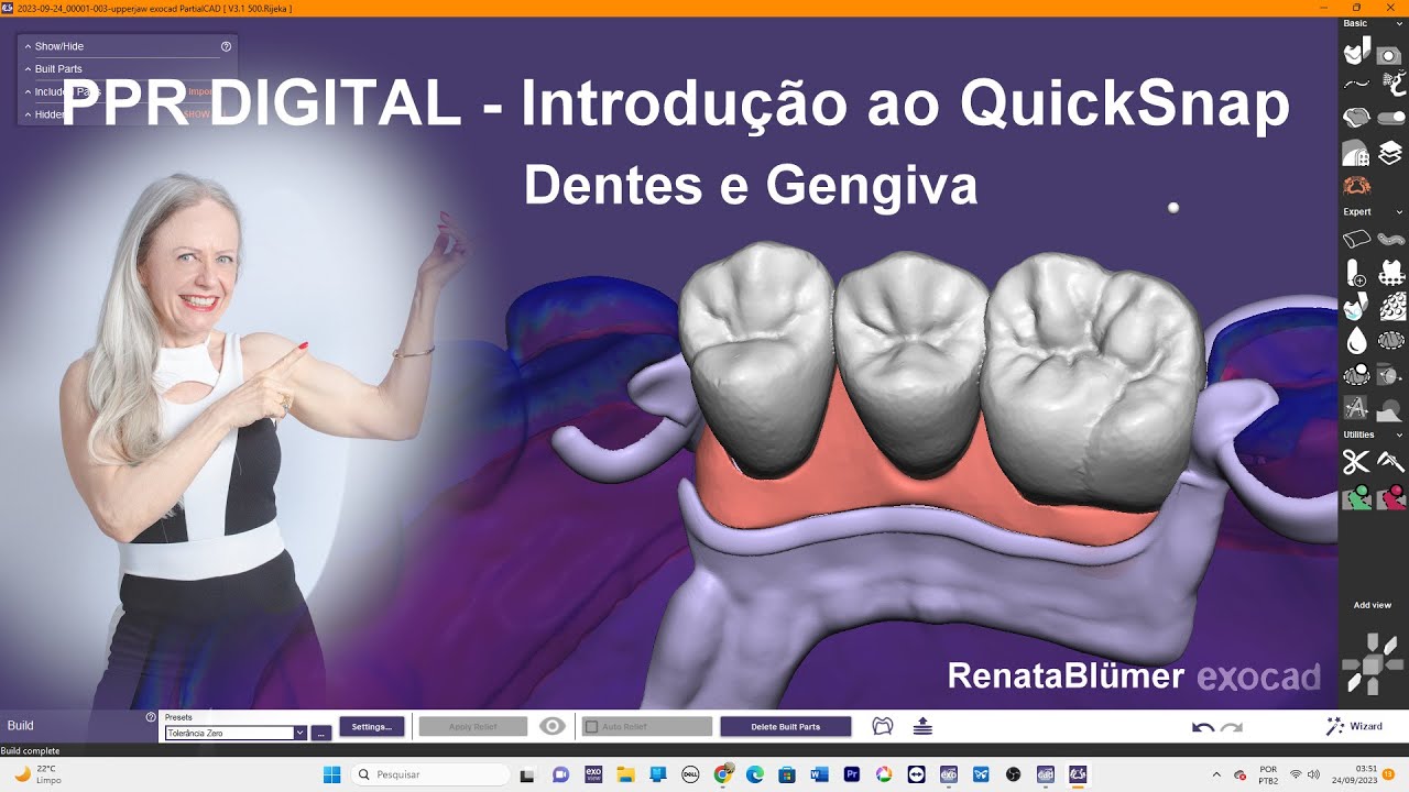 🎯Introdução ao QuickSnap Dentes, Gengiva e Estrutura exocad 3.1 Rijeka   #cursoppr  #montagemdentes