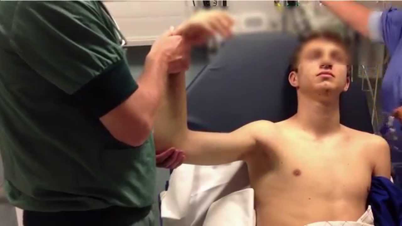 How to reduce an anterior shoulder dislocation