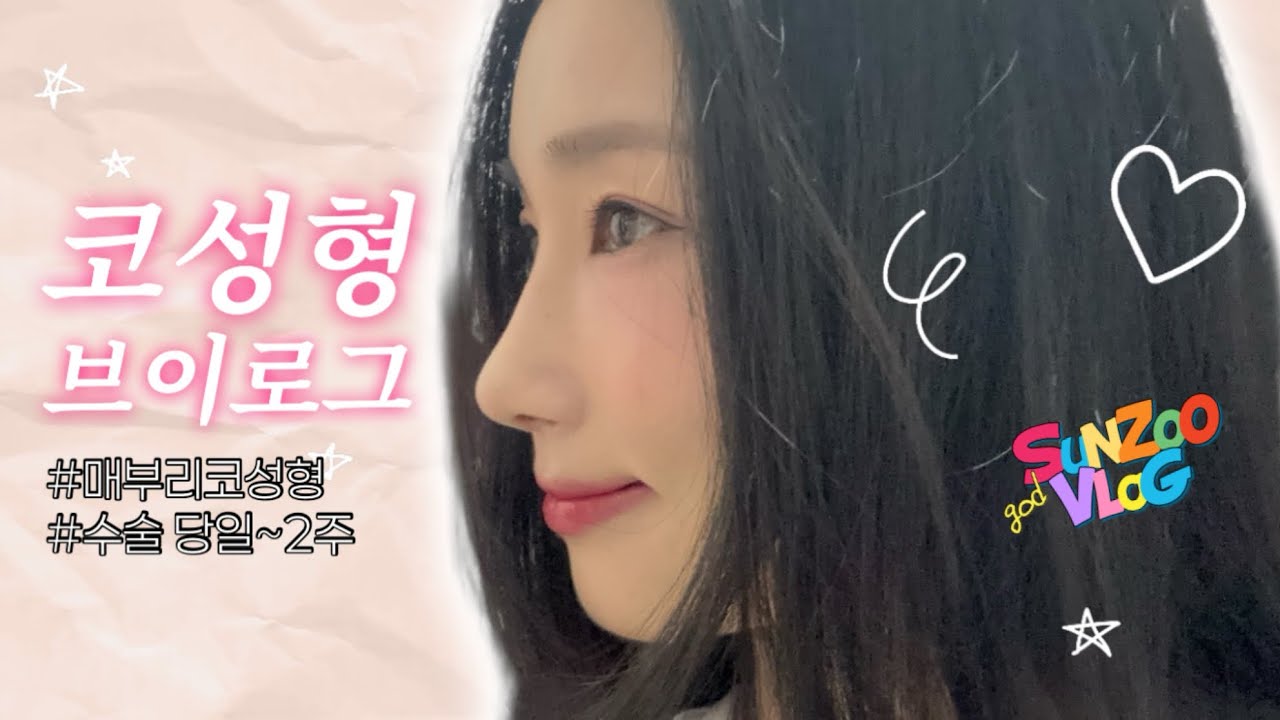 [VLOG] 드디어.. 코..했습니다!👃🏼| 매부리코 교정 |  무보형코성형 | 성형후기