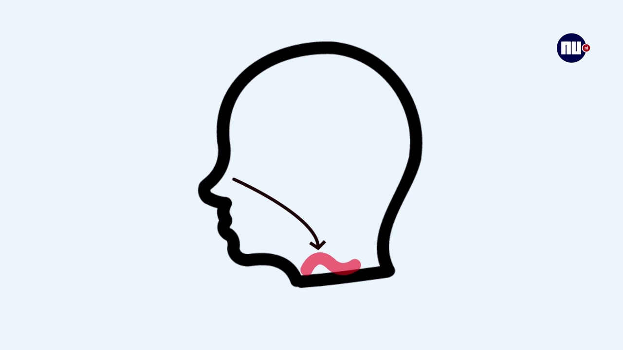 Tips van de dokter: Wanneer moet je met een verkoudheid naar de huisarts?