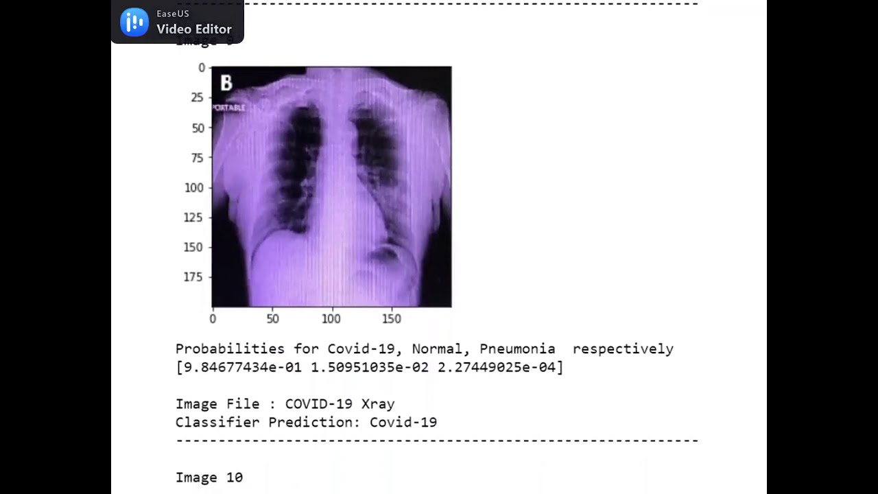Covid 19 Classification Model - DenseNet121