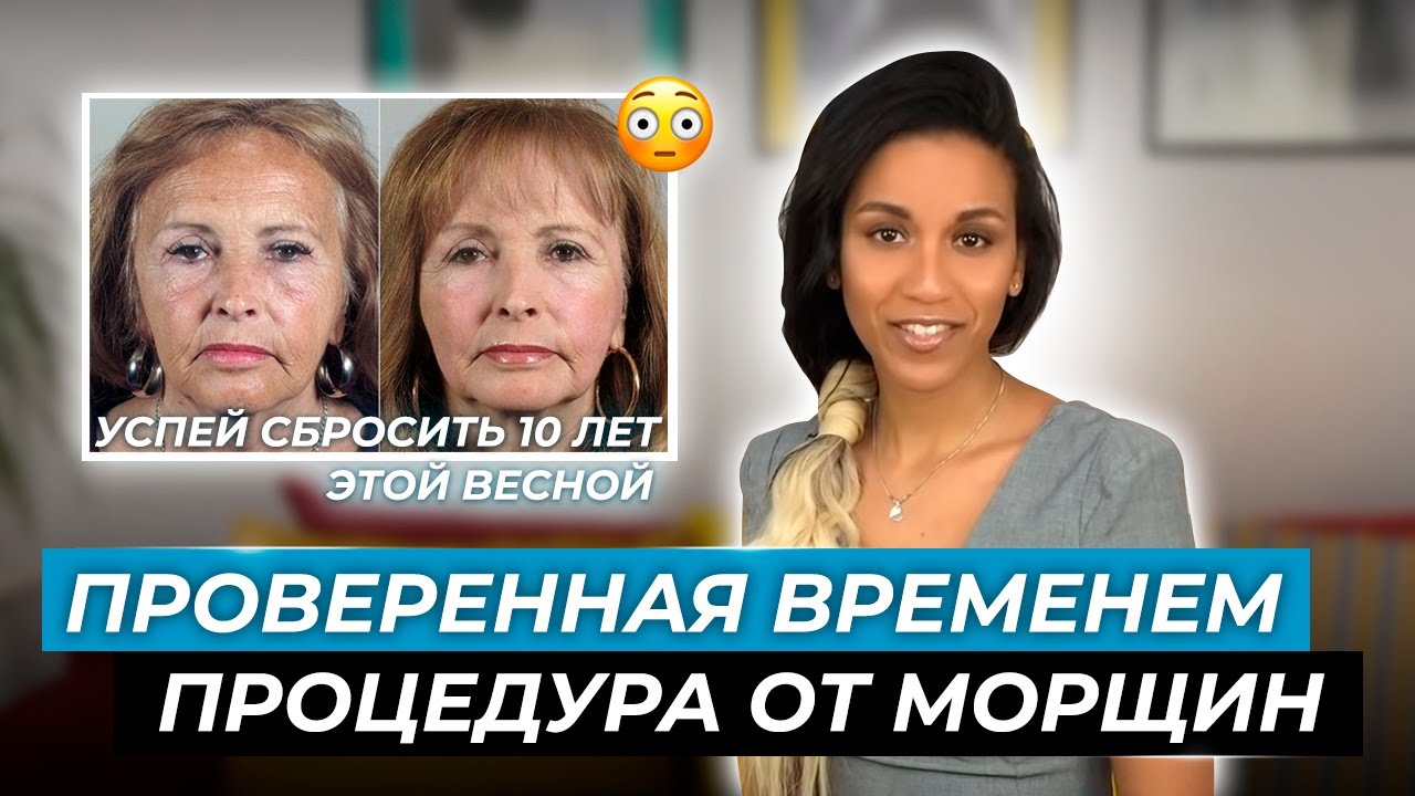 Альтернатива лазерному омоложению: трихлоруксусный пилинг // Как избавиться от морщин и постакне