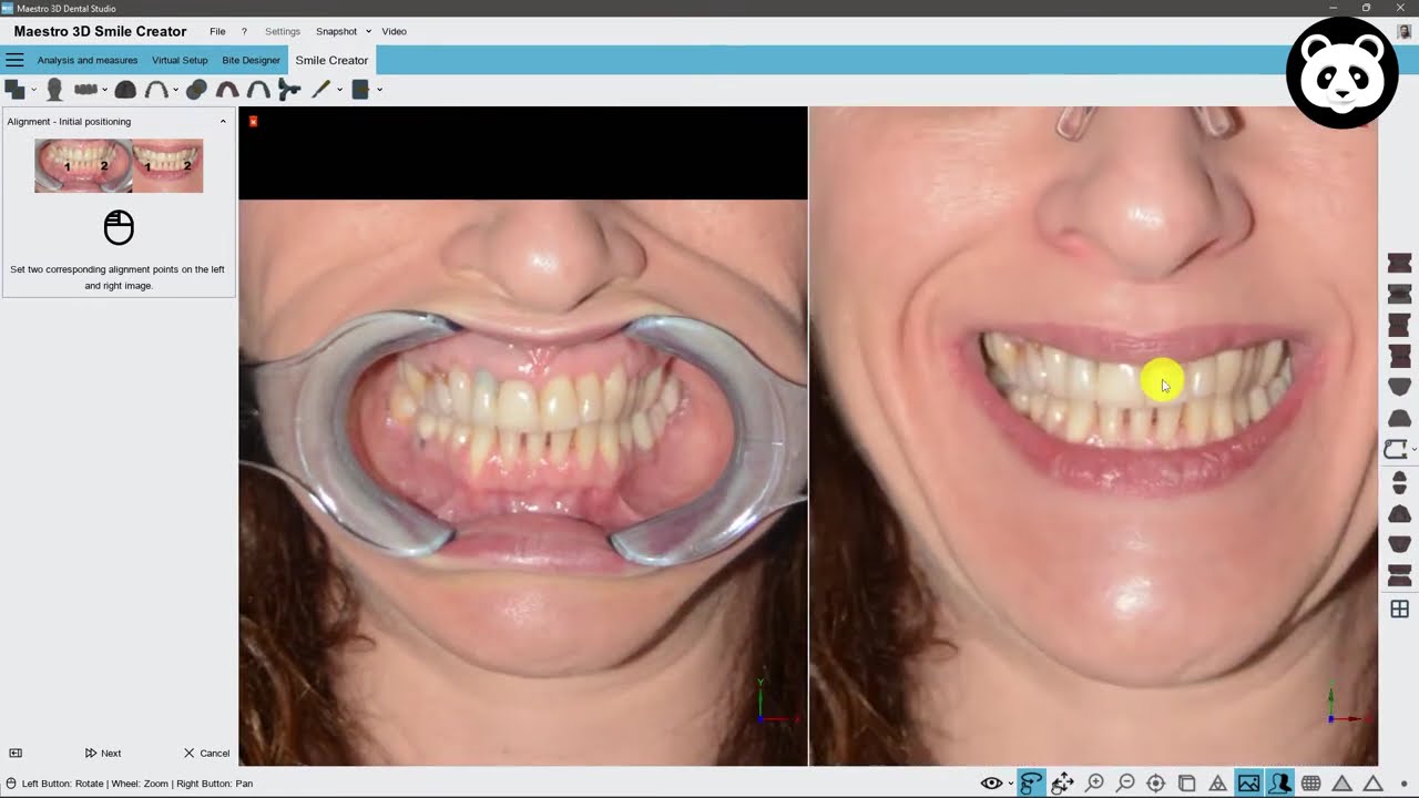 Maestro 3D | Dental Studio | Smile Creator | Digital Mockup | 3D Denture Guide