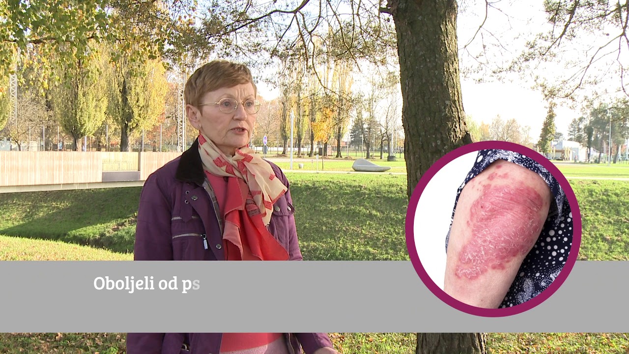 PSORIJAZA - ONLINE BAZA ZNANJA- VIDEO 2 