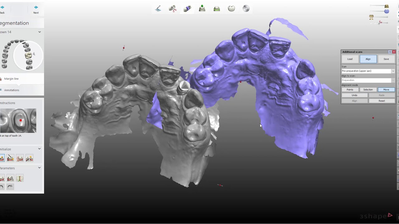 3Shape Scan Alignment