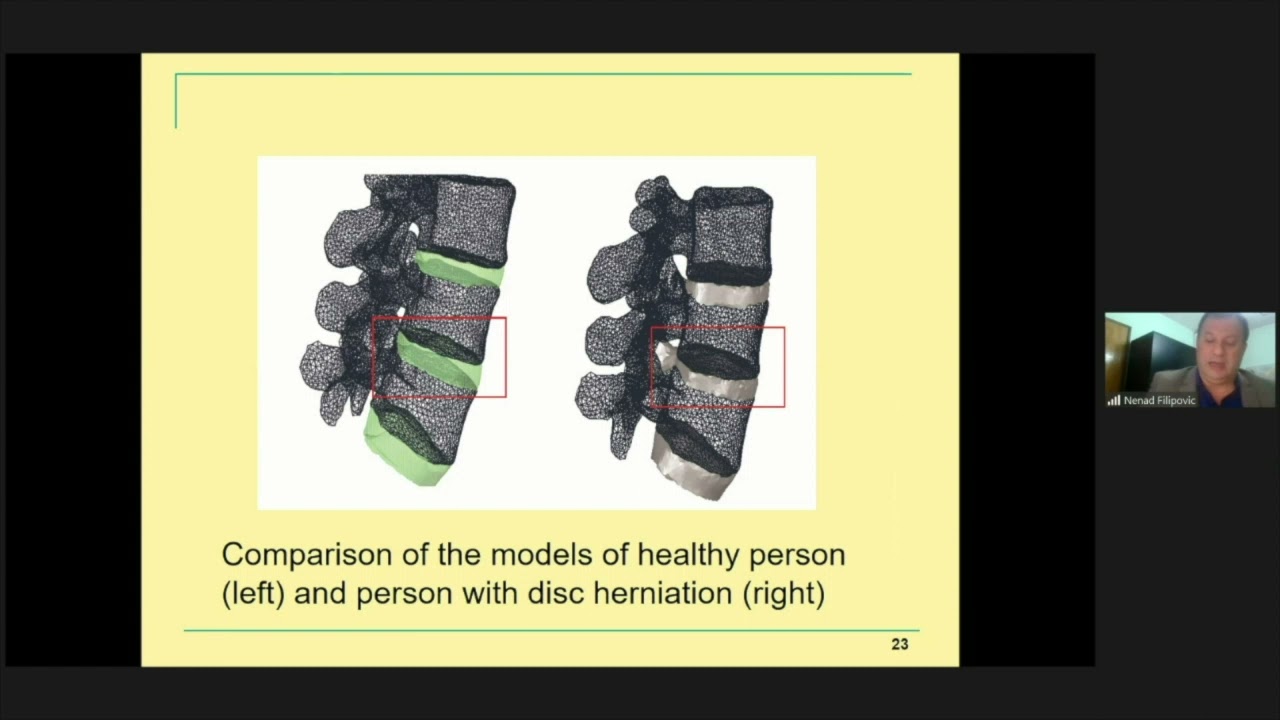 Computer modeling and artificial intelligence application in the spine biomechanics