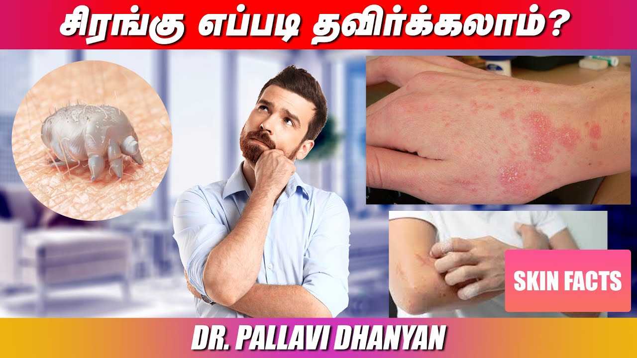 Scabies | How To Avoid It | Serangu | Dr.Pallavi Dhanyan