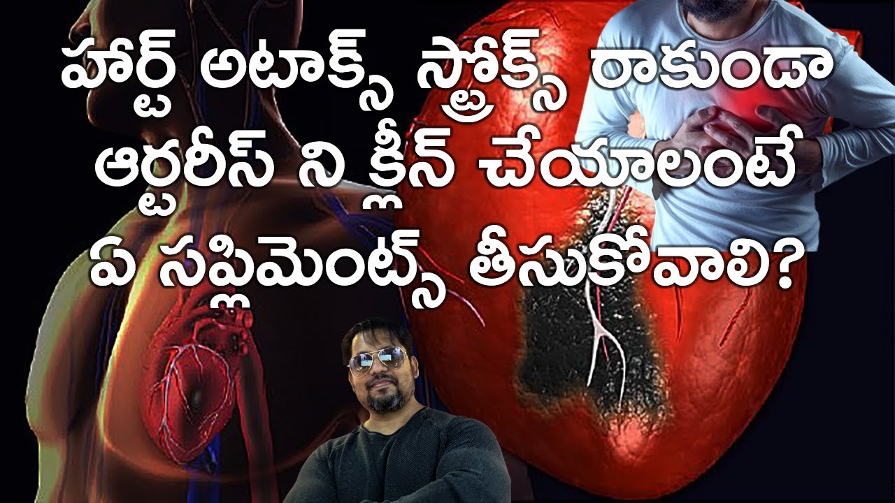 హార్ట్ అటాక్స్ స్ట్రోక్స్ రాకుండా ఆర్టరీస్ ని క్లీన్ చేయాలంటే ఏ సప్లిమెంట్స్ తీసుకోవాలి? Niacin Dose